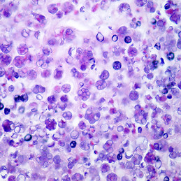 haematoxylin 