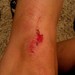 My first fall from the bike or how I crashed my bike...